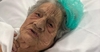 Прооперированная на тазобедренном суставе 104-летняя итальянка выписалась из бол