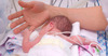 В Милане спасли новорожденную с опухолью сердца, в два раза превышавшей его разм