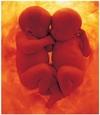 Итальянские ученые обнаружили, что близнецы общаются, находясь еще в утробе мате