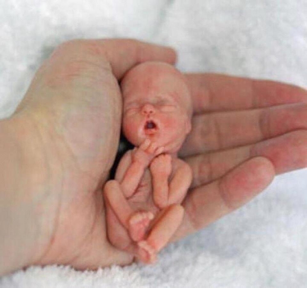 Зародыш В 12 Недель Беременности Фото